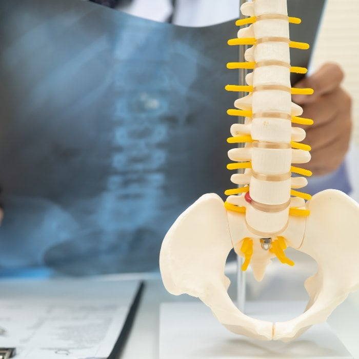 Chiropractic spine care San Jose